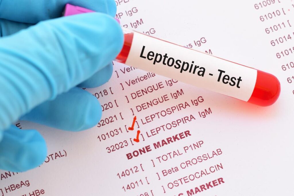 beware Of Leptospirosis Infection In Rainy Season